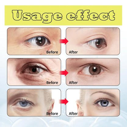 Celimax Retinal Shot Tightening Booster